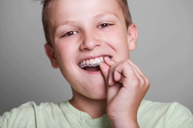 Invisalign Teen