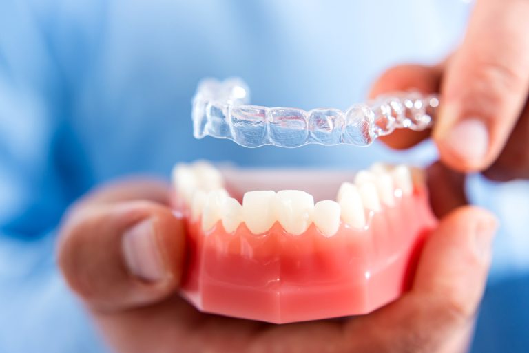 Invisible and removable aligners for teeth alignment